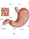 [第063期]萎缩性胃炎的预防与治疗